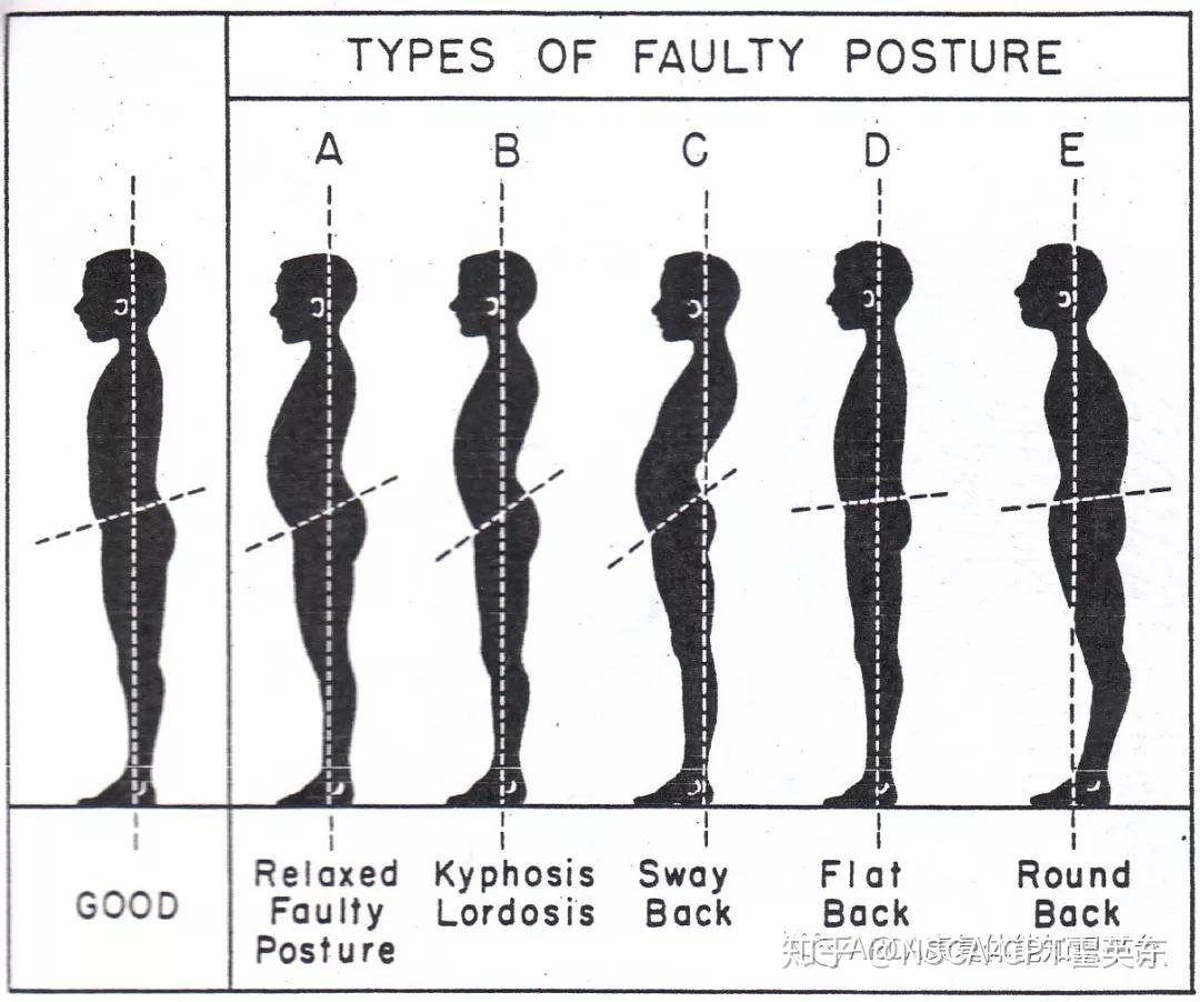 靠意念矫正体态居然是真的啊