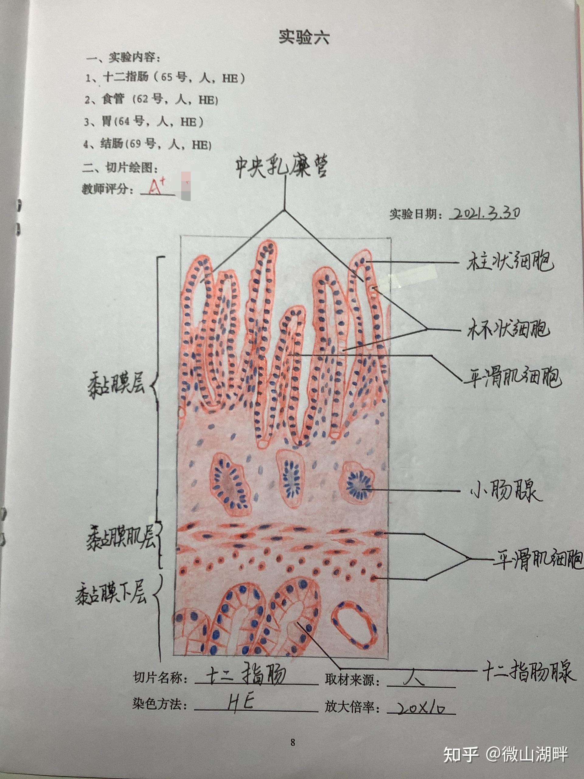 小肠细胞手绘图红蓝图片