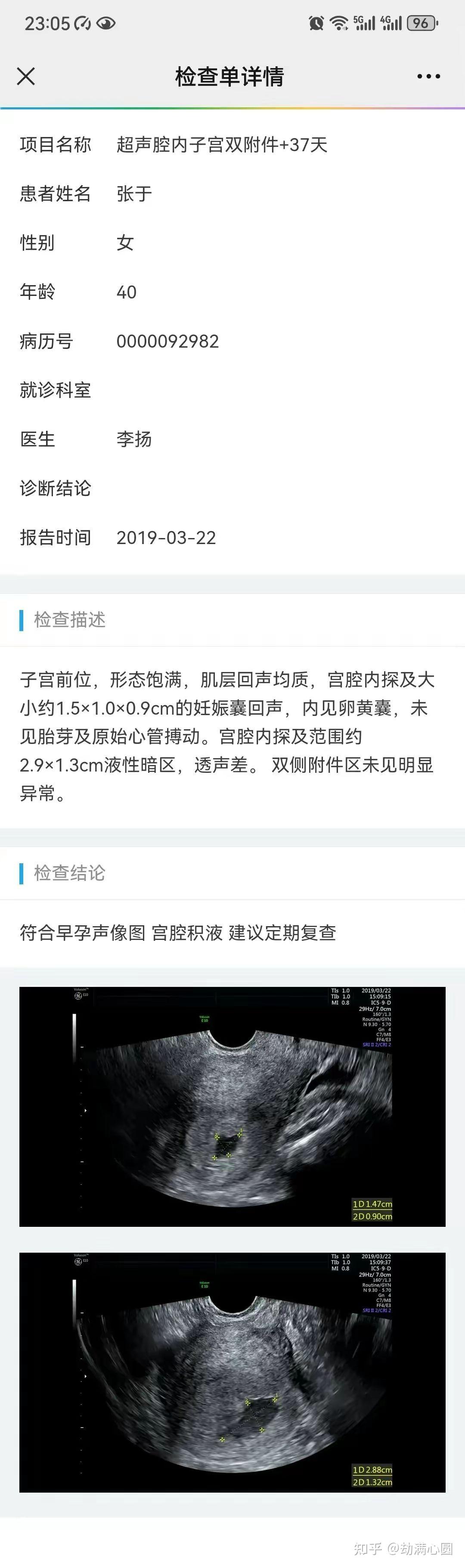 銀泰黃金公司這麼做,是認為張某被丈夫舉報,只是一般的男女生活作風