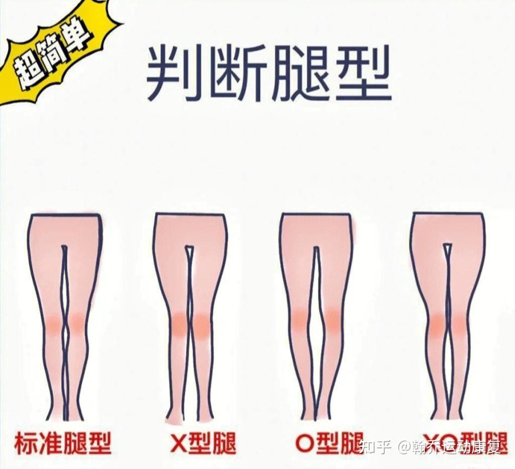 女生6种好看的腿型，你是哪一种? - 知乎