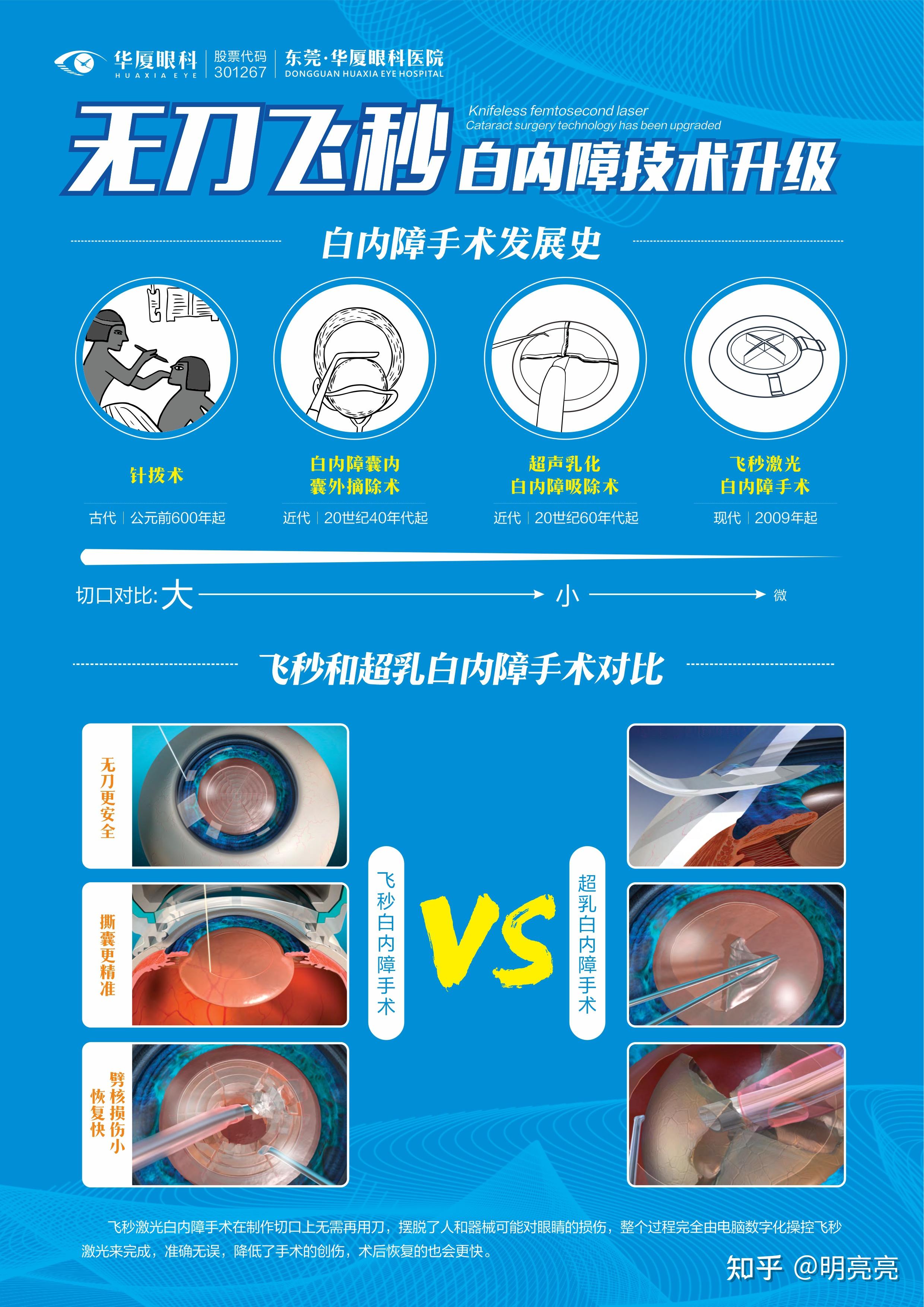 原来"飞秒激光"也能辅助白内障手术!