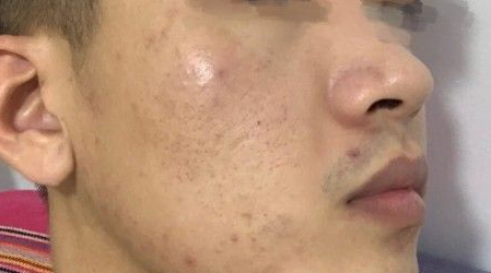 开学前男生如何提升颜值