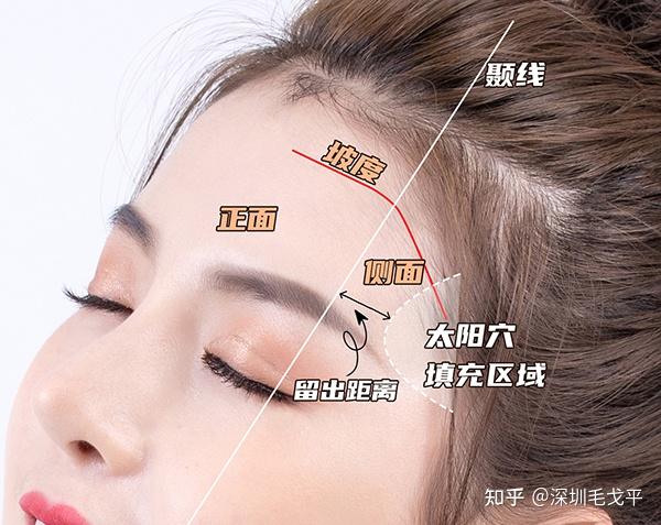 另外,好看的额头侧面一定是有转折的,从颞线到太阳穴呈现一个坡度,而