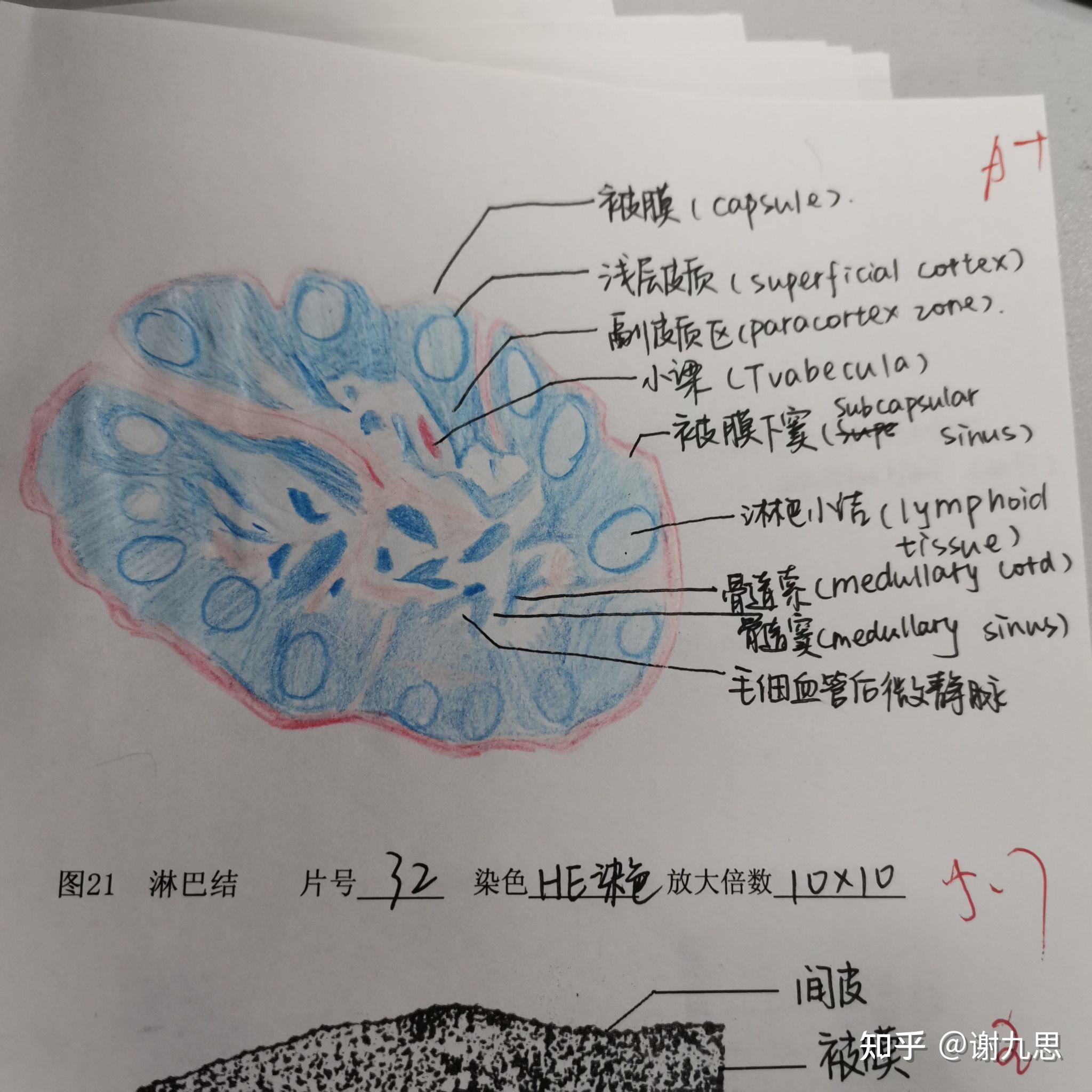 淋巴母细胞手绘图图片