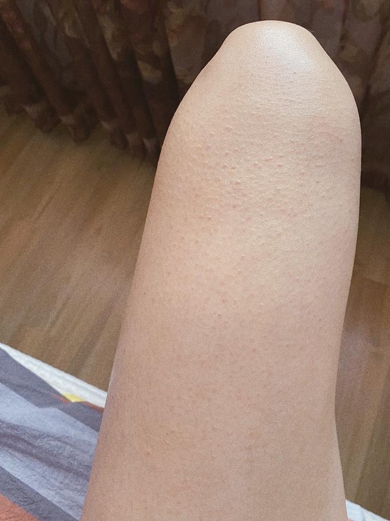 立马就化开了,用完肌肤水润润的她之前不用身体乳的时候皮肤可不这样