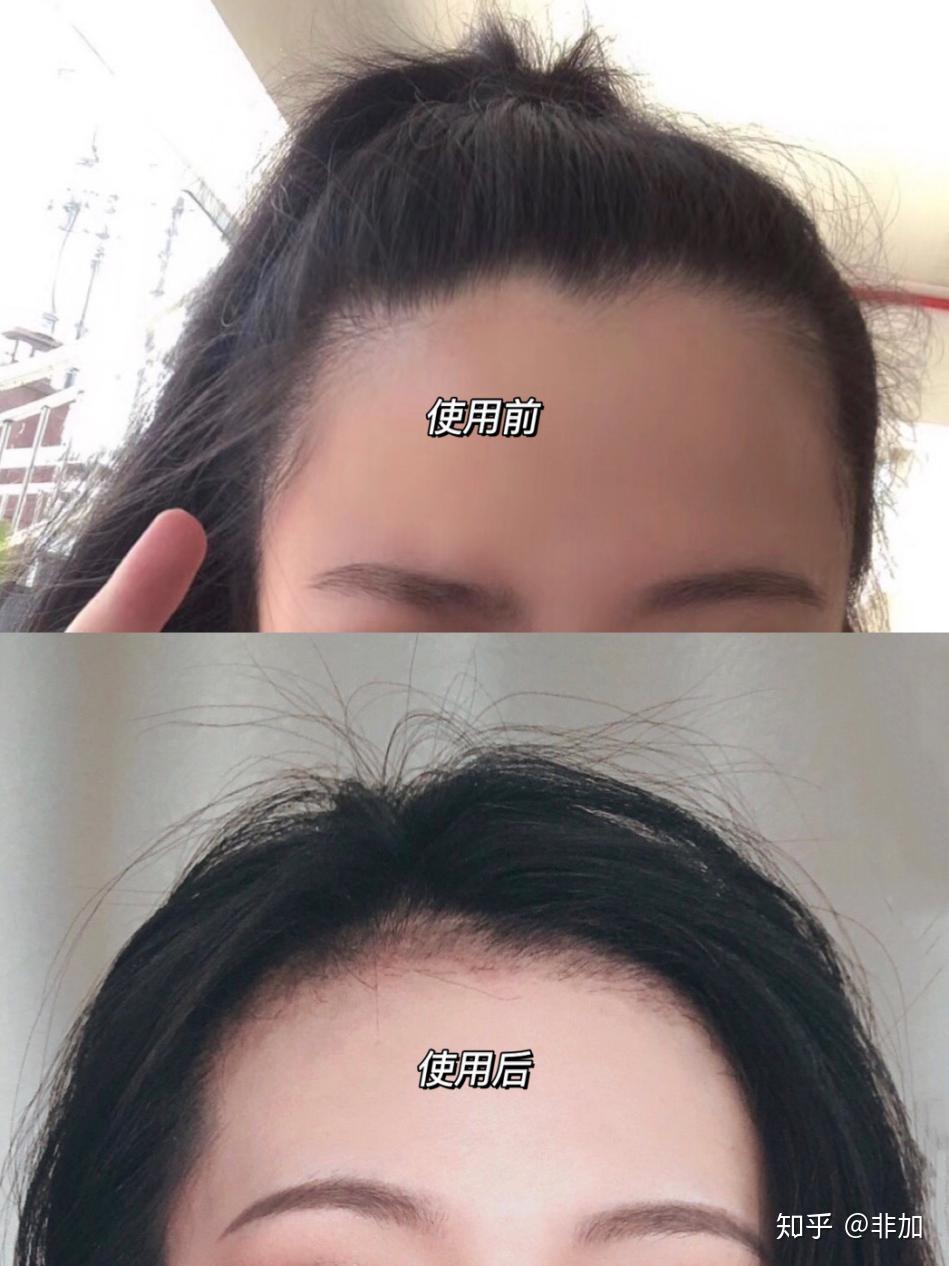 怎么拥有高颅顶发型 v2-155c2b956050510bd43fe173d02888bb_r.jpg