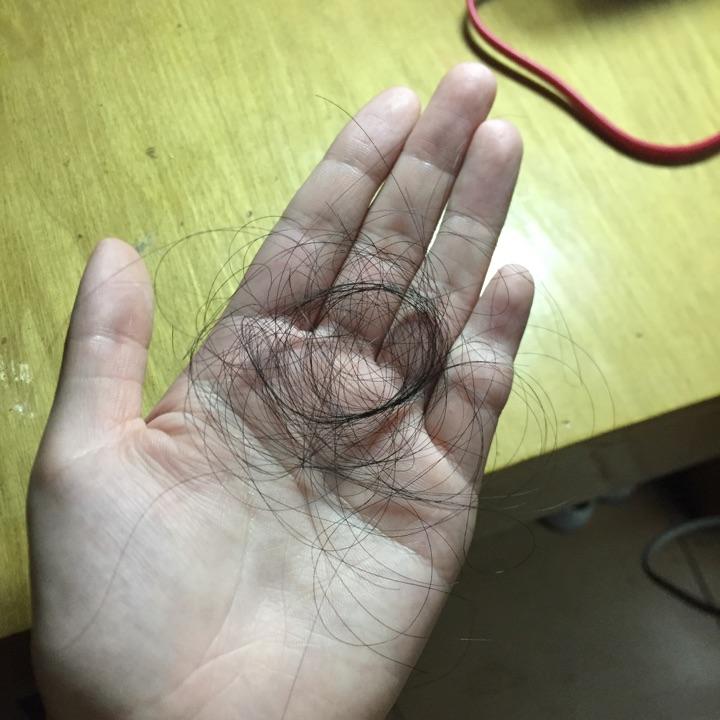 维生素B6,胱氨酸,鱼肝油一起吃可以治疗脱发吗