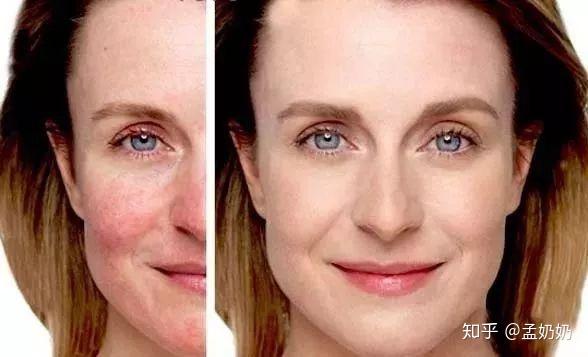 这样的满面红光你喜欢吗