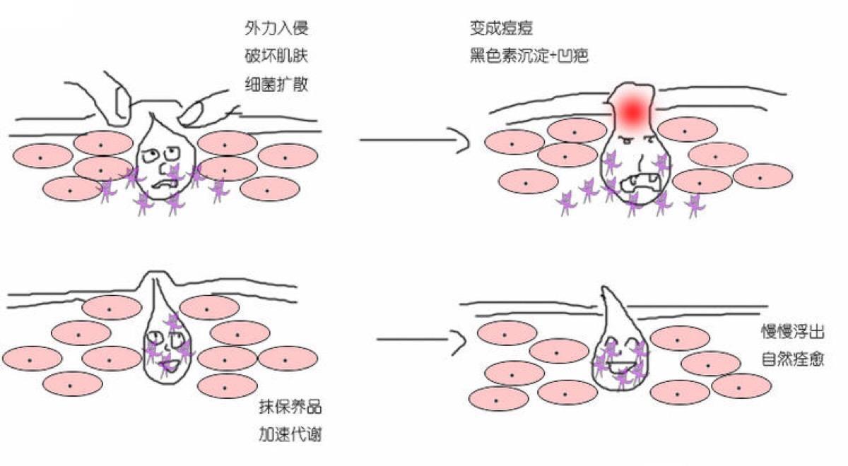“闭口”的那些事儿,你怎能不知道?! - 知乎