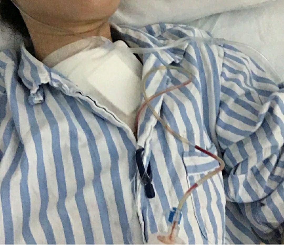 你知道正常人如何检查甲状腺肿大吗