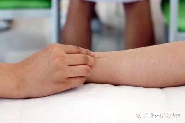中医特色腕踝针法进针点及行针手法创新 - 知乎