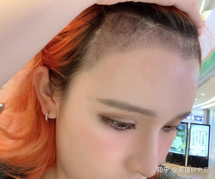 女生头顶头发少是什么体验