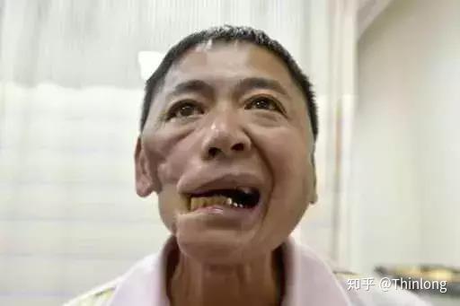 央视辟谣 槟榔不致癌 这是真的吗 知乎 央视辟谣 槟榔不致癌 这是真的吗 知乎