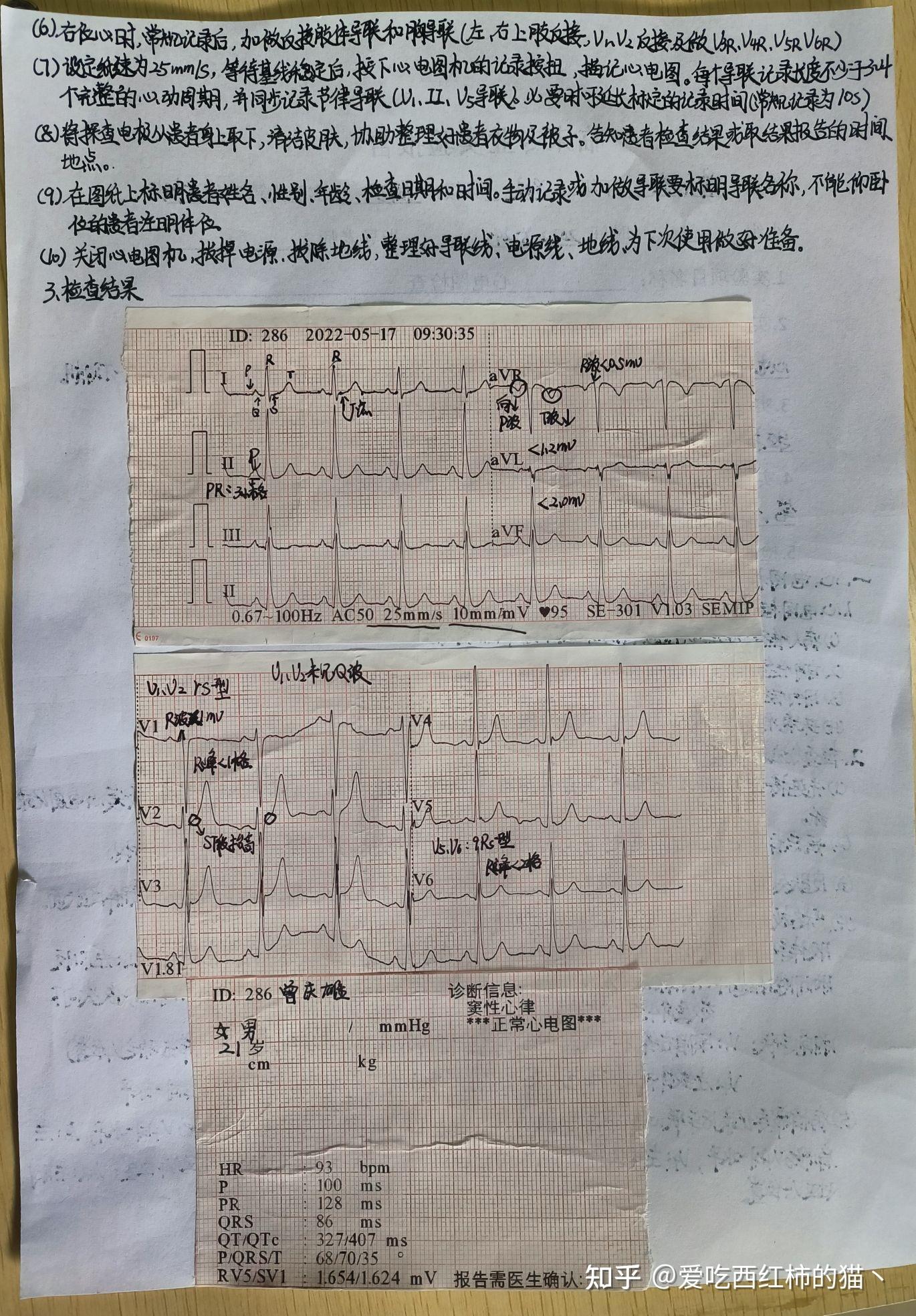 第五次实验课:心电图第六次实验课:脊柱四肢神经系统体格检查第五次