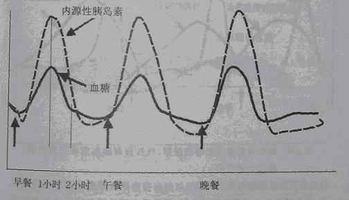 哪些食物可以减少胰岛素分泌 v2-1669f1db92a7462e2606d667a2143a6b_r.jpg