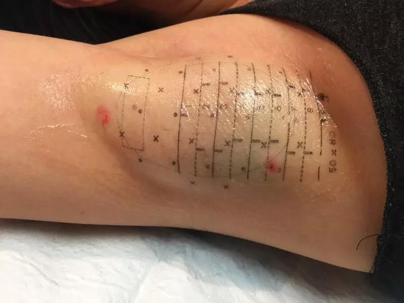 八大处整形冯永强 67 中国医学科学院整形外科医院激光美容中心副