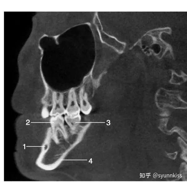  cbct 