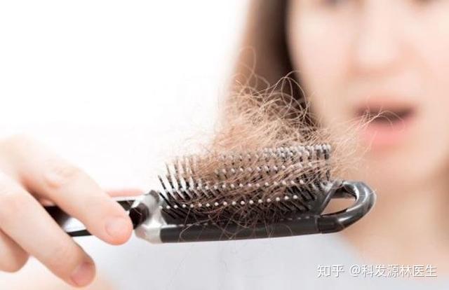 防脱发产品真的可以防止你掉头发吗