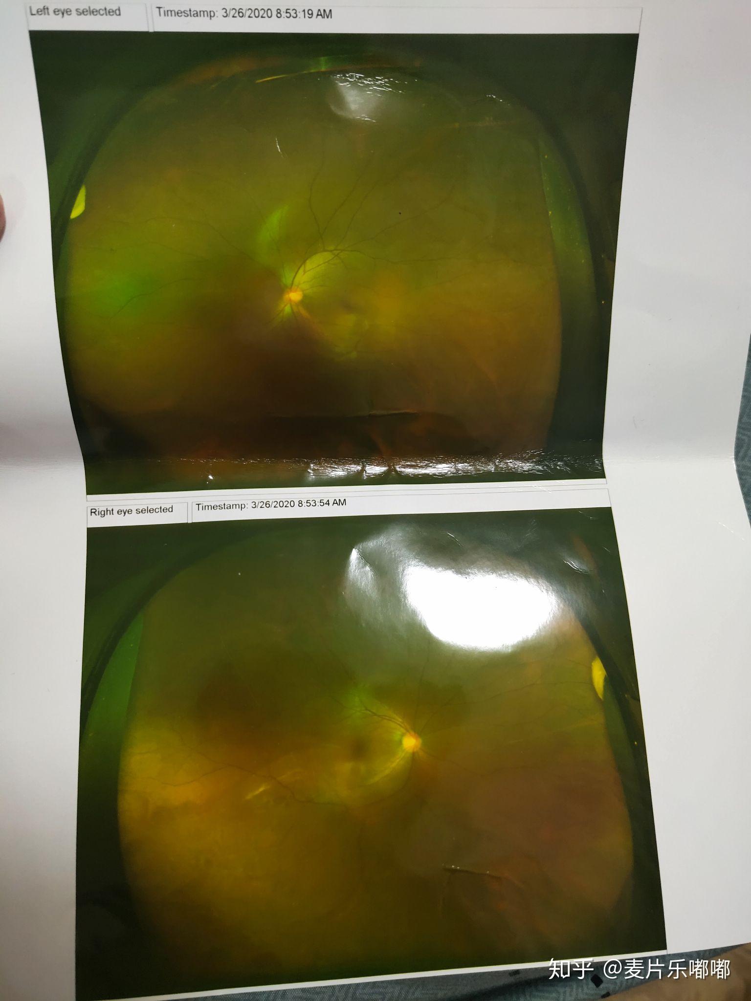 v2-16cb3272eb9ec13ec844535ef9f568eb_r.jpg