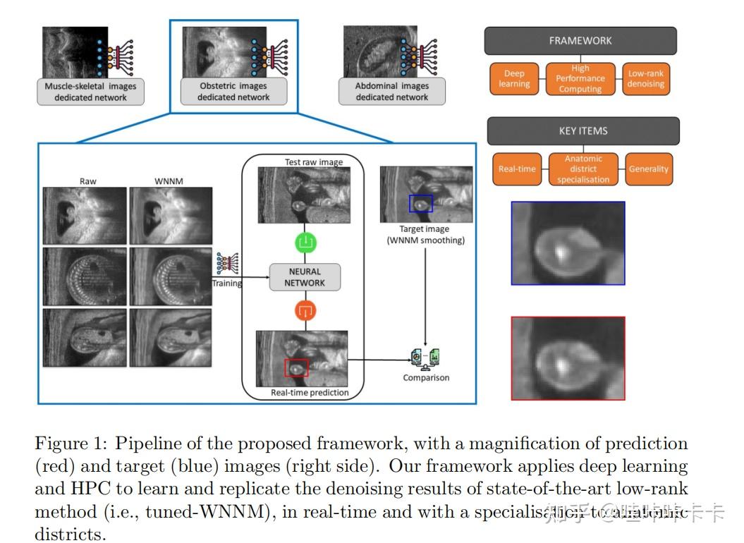 A Universal Deep Learning Framework for Real-Time Denoising of ...