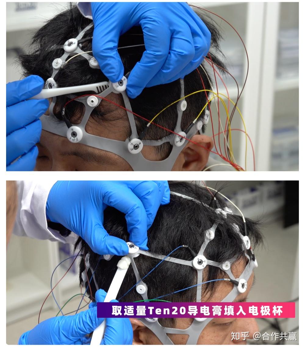 断开转接线缆与盘状电极线束,整体摘下脑电帽(电极线束无需从脑电帽上