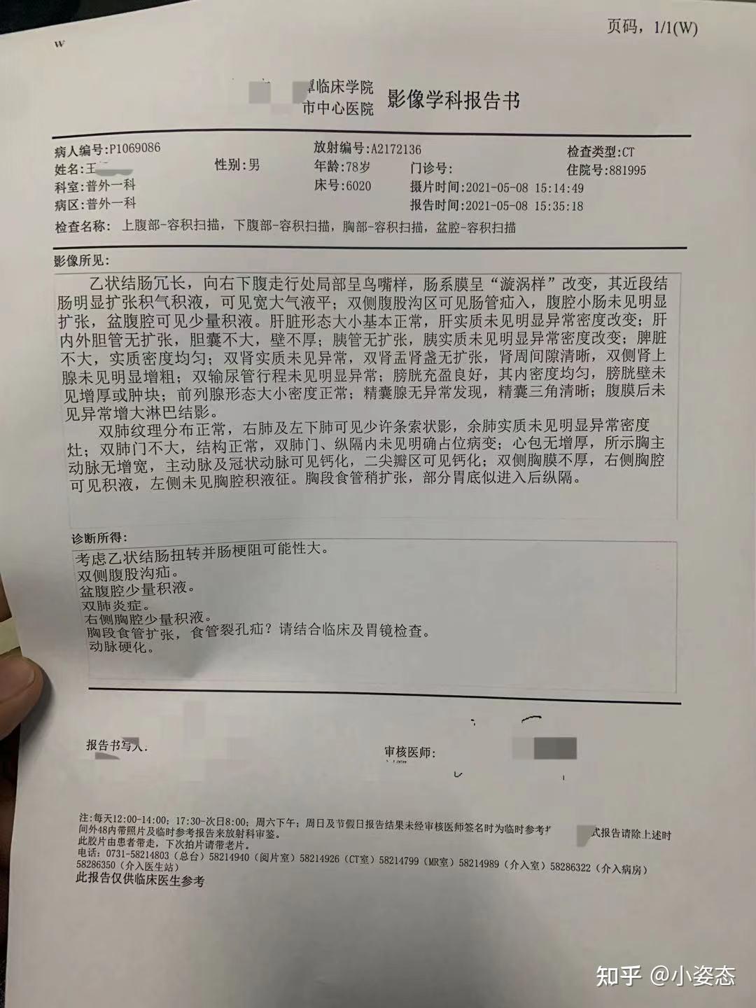 肠梗阻CT报告图片