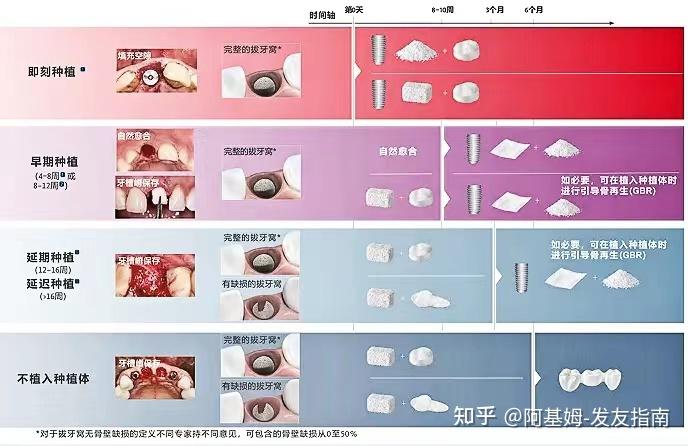 活动牙好还是固定牙好图片