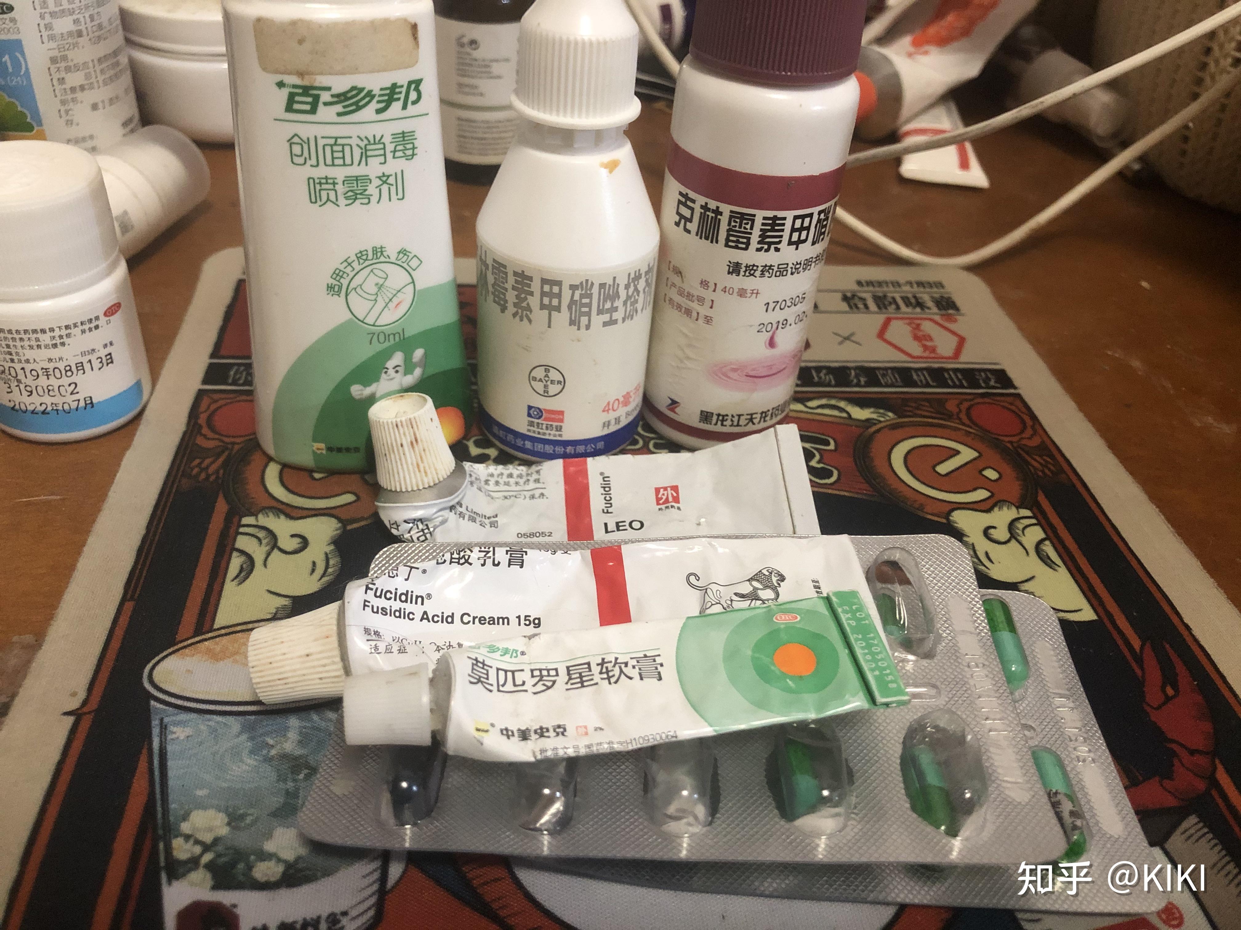 常用外用抗生素包括红霉素,林可霉素及其衍生物克林霉素,氯霉素,氯洁