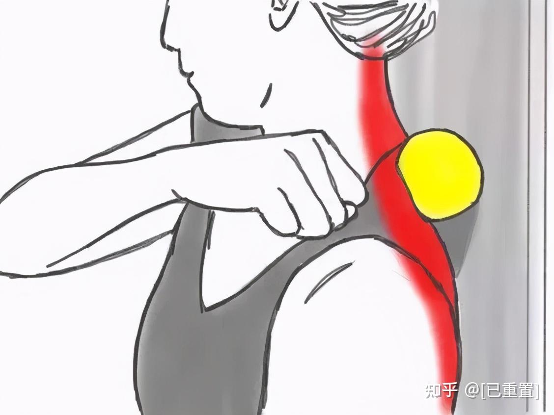肩颈痛怎么办如何缓解（颈肩痛如何治疗？医生回答：应根据症状，来选择方法） | 说明书网