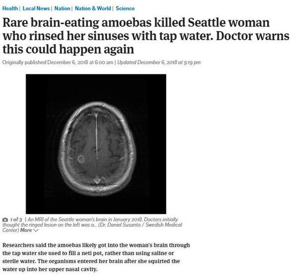 这个缓解鼻塞的小方法 医生都在推荐 知乎