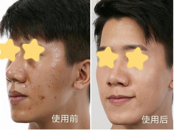 摆脱大油田——控油是关键!