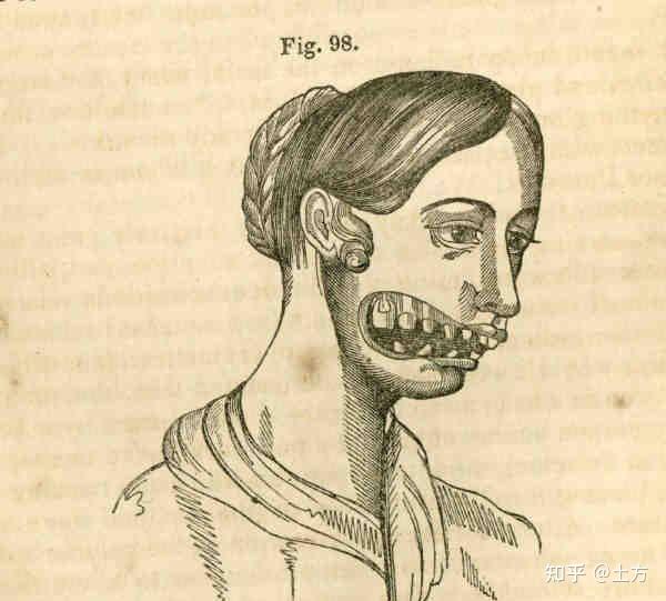 镭女郎的故事 - 知乎