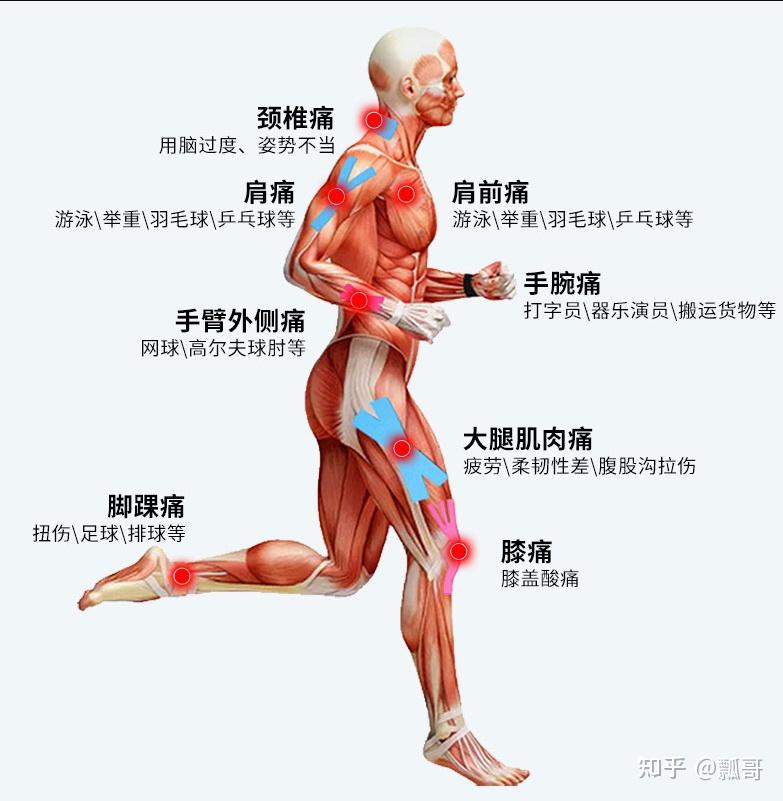 筋膜是包裹在全身各部位肌肉表面的一层非薄膜性结构,是一种纤维结缔