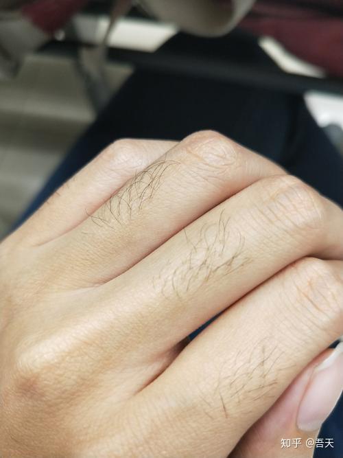 人类褪去全身的体毛，为什么恰恰要留下头发、腋毛和阴毛呀？ - 知乎