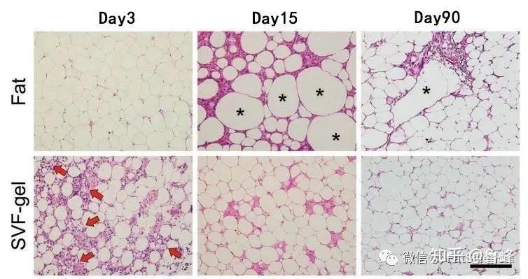 脂肪干细胞胶SVF-gel移植后是如何长出脂肪的？ - 知乎