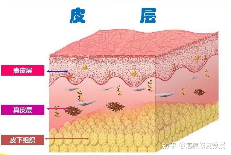 增生性疤痕怎么办？如何修复祛除？医生带你正确认识和治疗