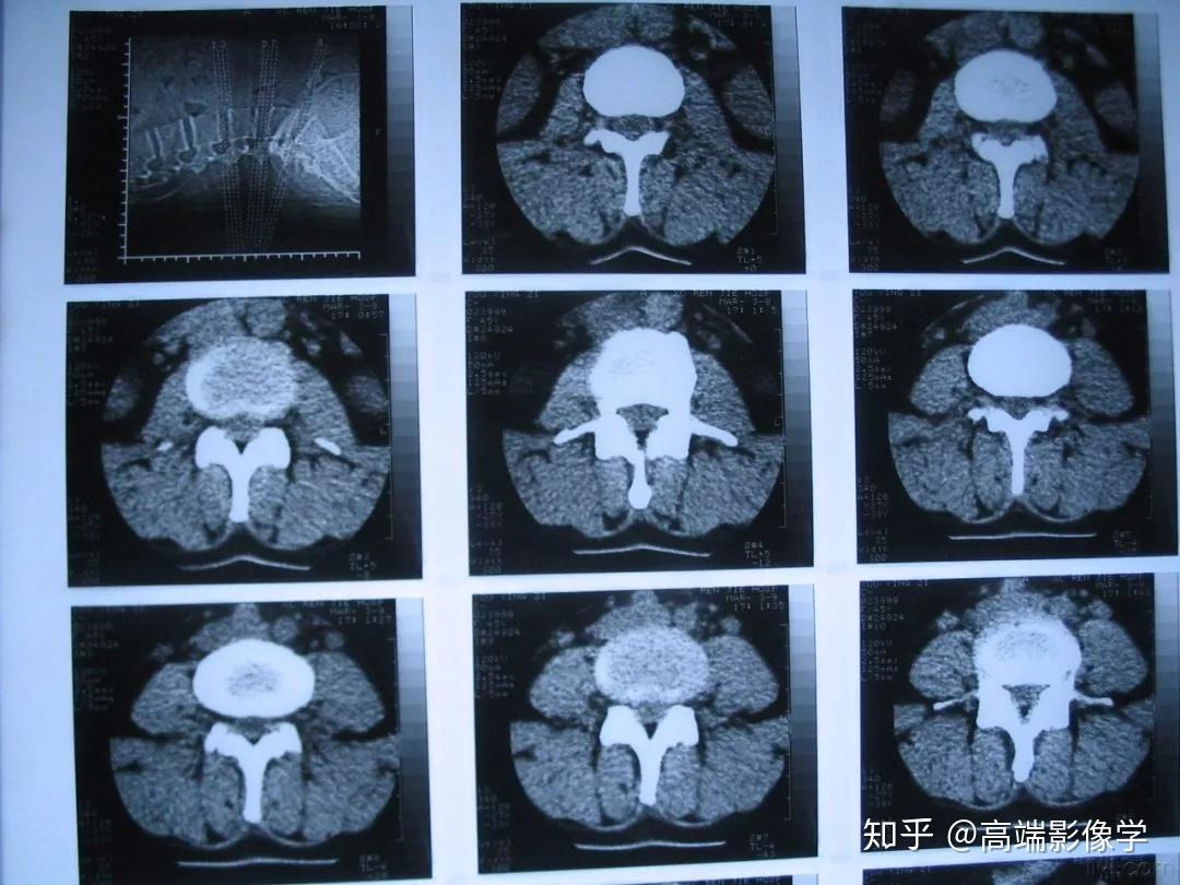 知识贴:x光,ct,b超,磁共振,区别到底在哪?了解这些才能对号入座