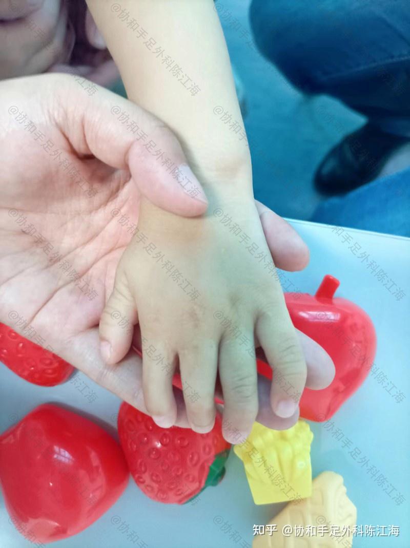每30秒就会诞生1名缺陷儿!注意这4点,降低孩子出现畸形的几率 - 知乎