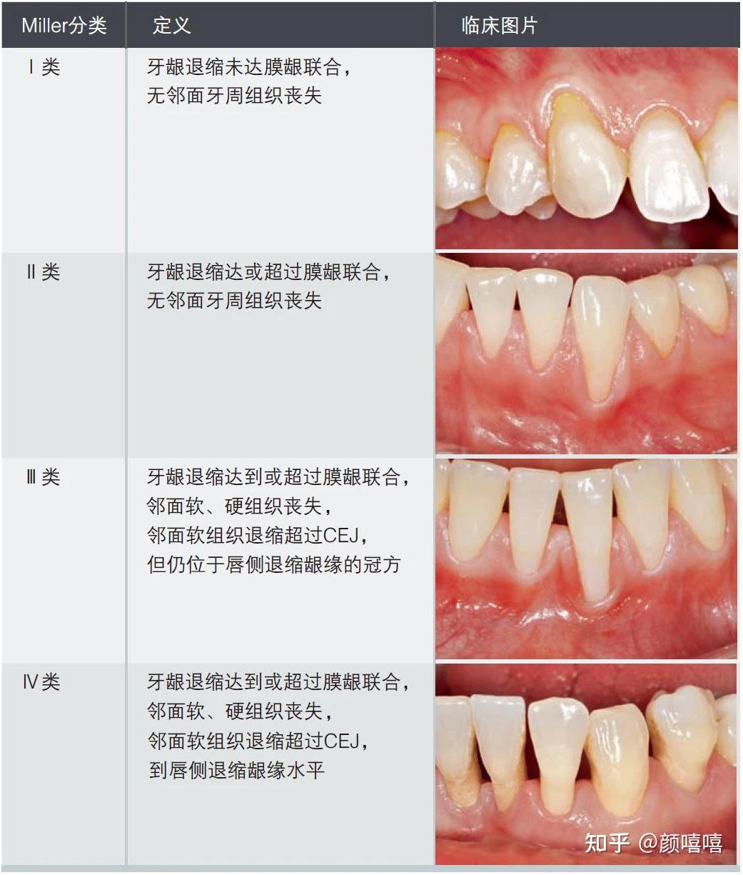 成人牙齿的名称示意图图片