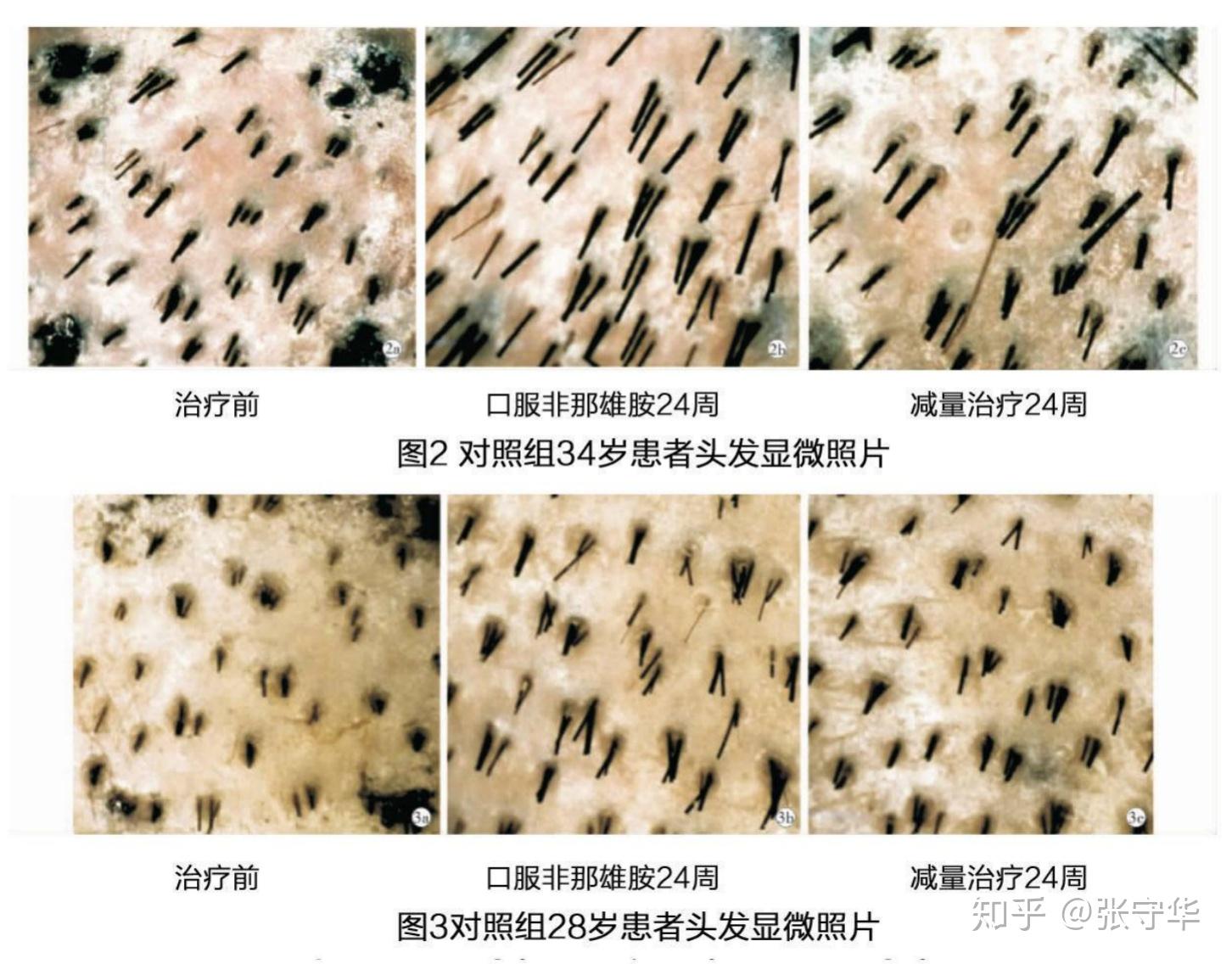 v2-19cdf4026c3bff38a1a988a300cf7a2f_r.jpg