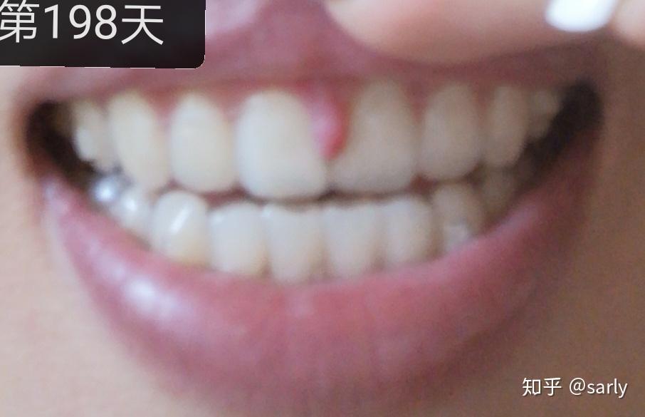 v2-19f6cf5d6c23836bba7be124043eeb97_r.jpg