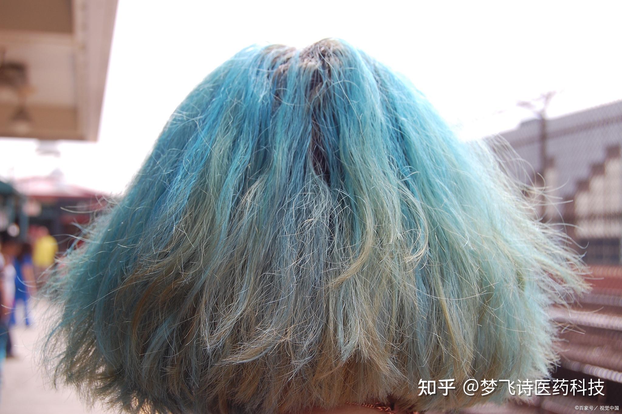 为什么染发后掉发严重