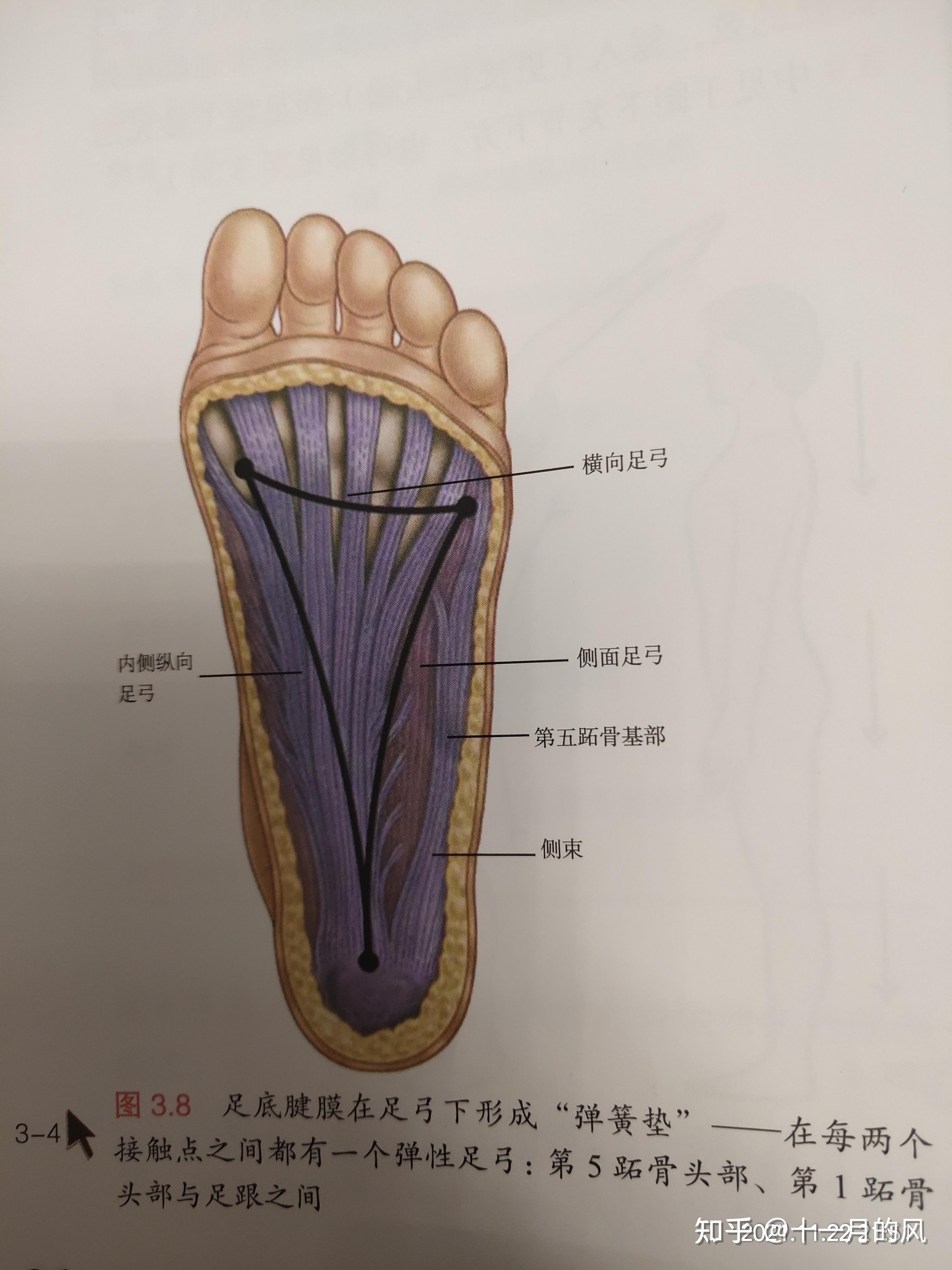 足底筋膜炎解剖图图片