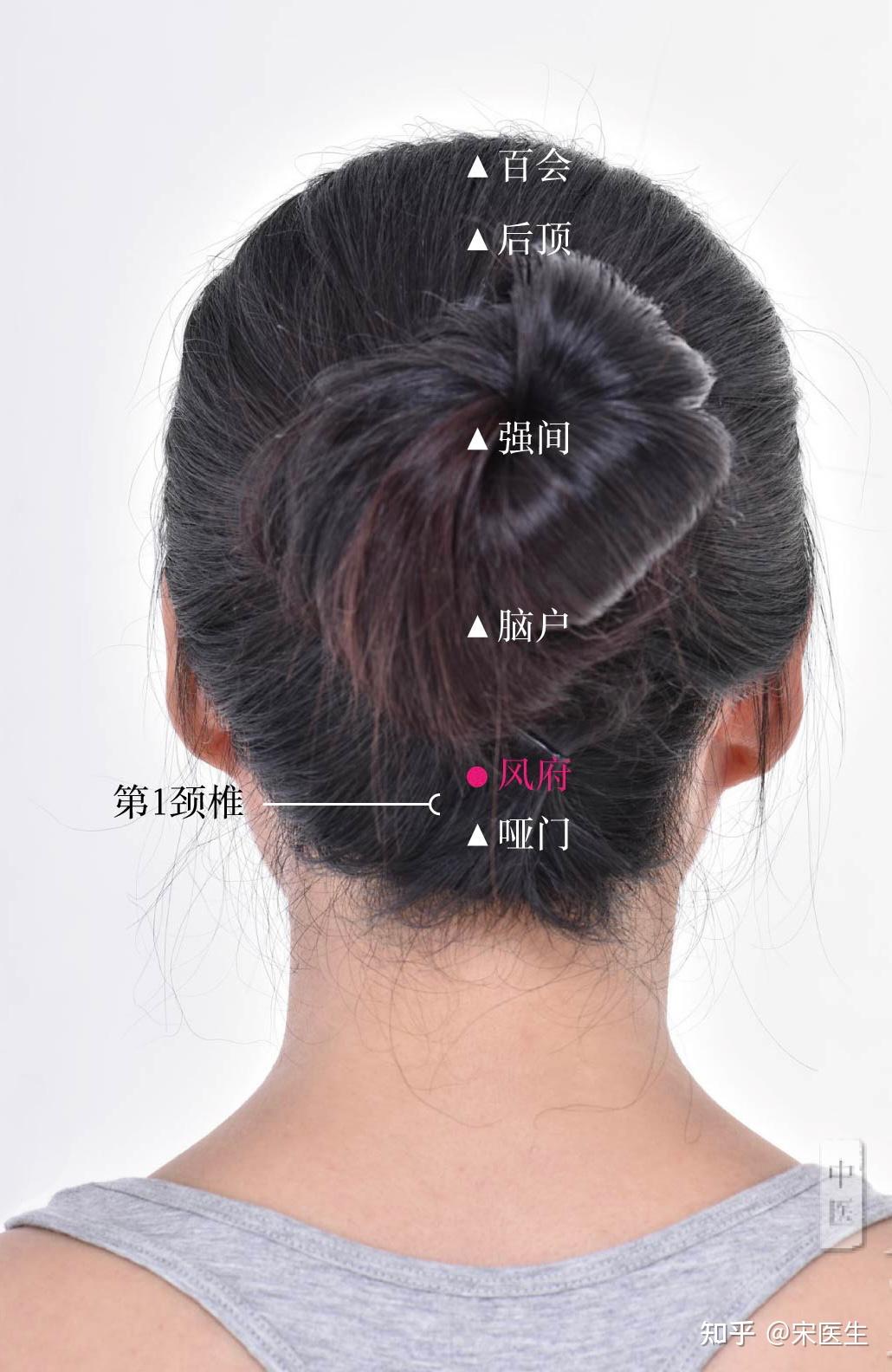 风池、风府、风门三穴的治疗作用有何异同? - 知乎