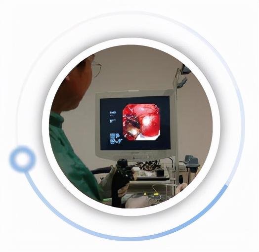 氩离子凝固术在手术中的应用