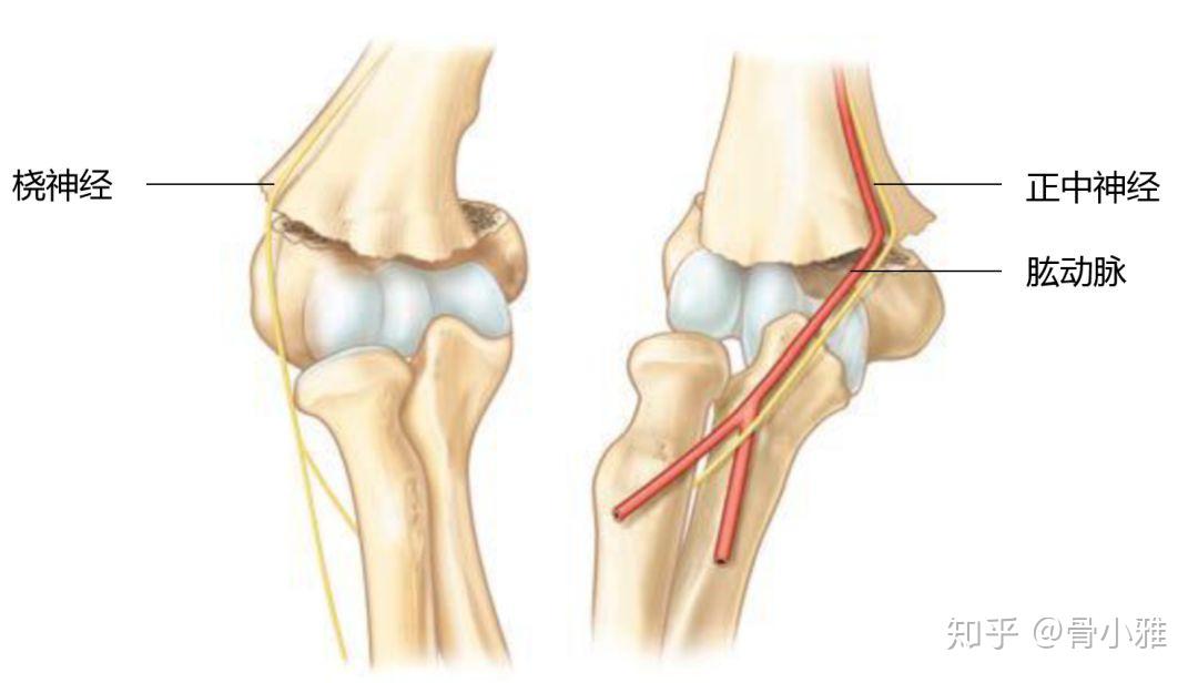 肱骨髁上骨折位置图图片