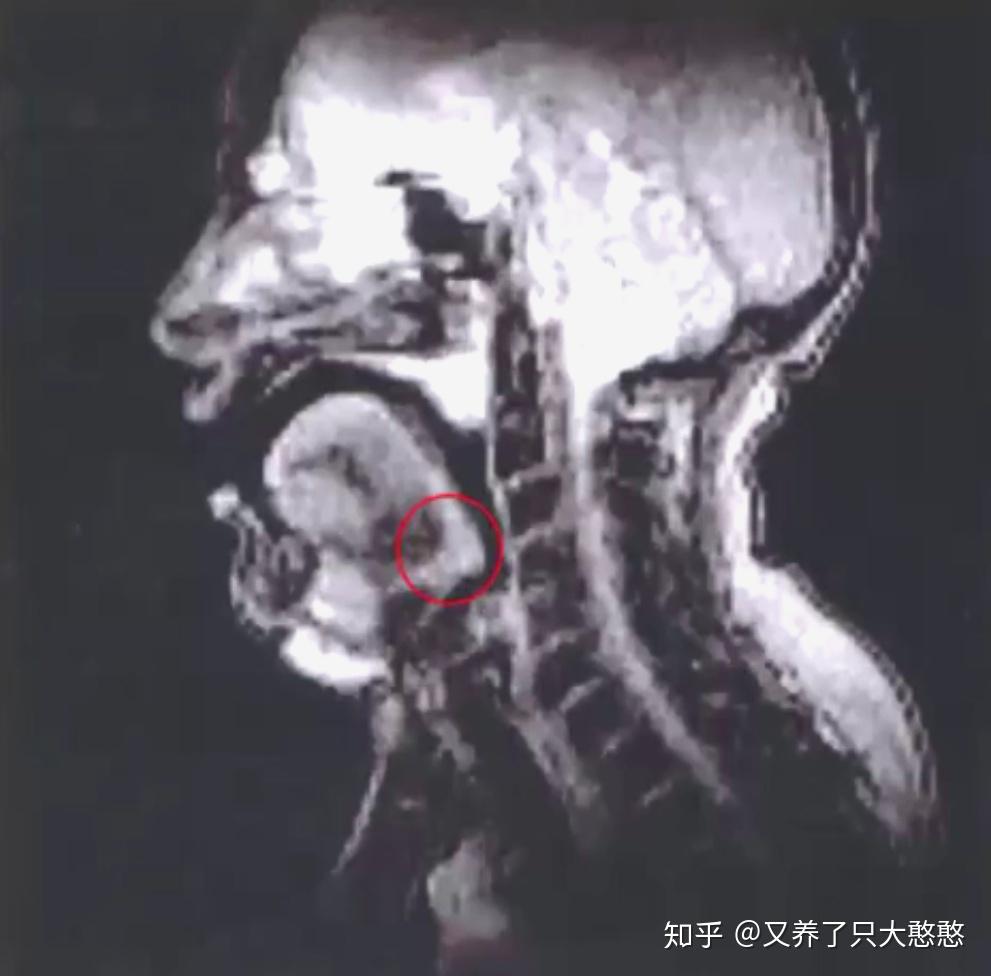 关于歌手共振峰和Twang更详细的内容 - 知乎