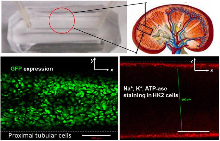 器官芯片实例介绍三kidneyonachip芯片肾