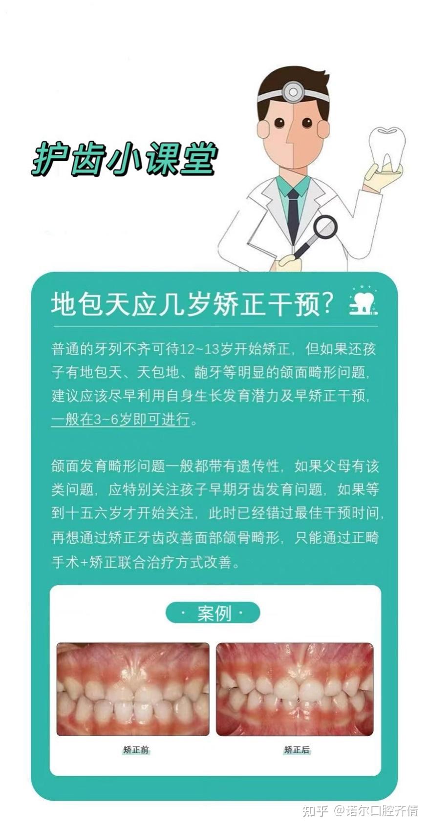 地包天应几岁矫正最合适? - 知乎