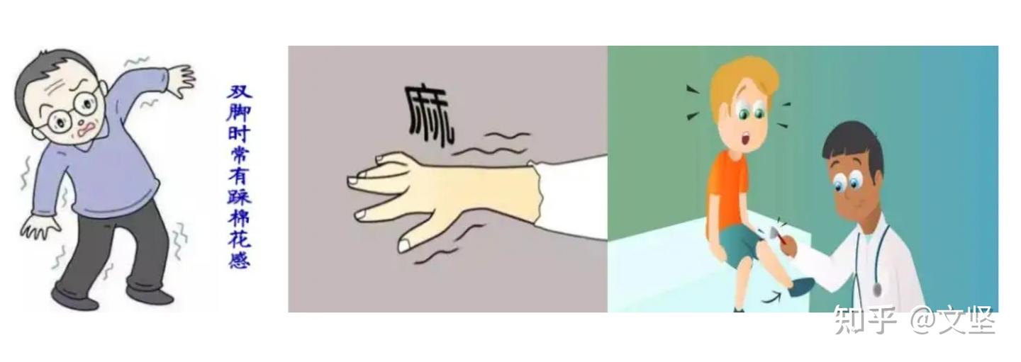 颈椎病主诉 - 知乎